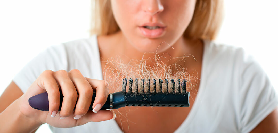 Випадання волосся: алопеція своїми руками?