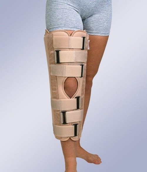 Сильний удар колінної чашечки при падінні лікування в домашніх умовах