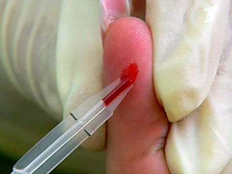 Аналіз крові на вірус краснухи