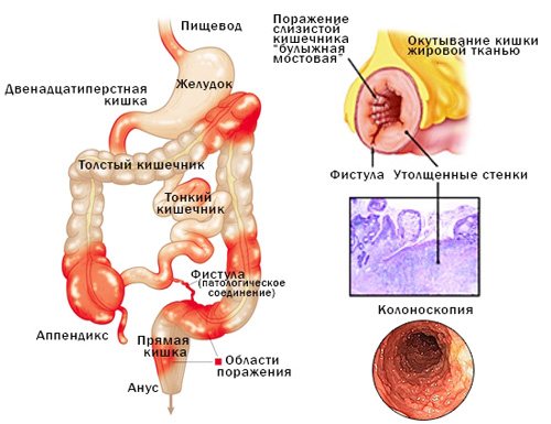 анатомія шлунково-кишково тракту людини й діагностика хвороби