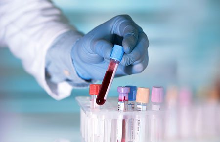 Біохімічний анали крові, показники і норма
