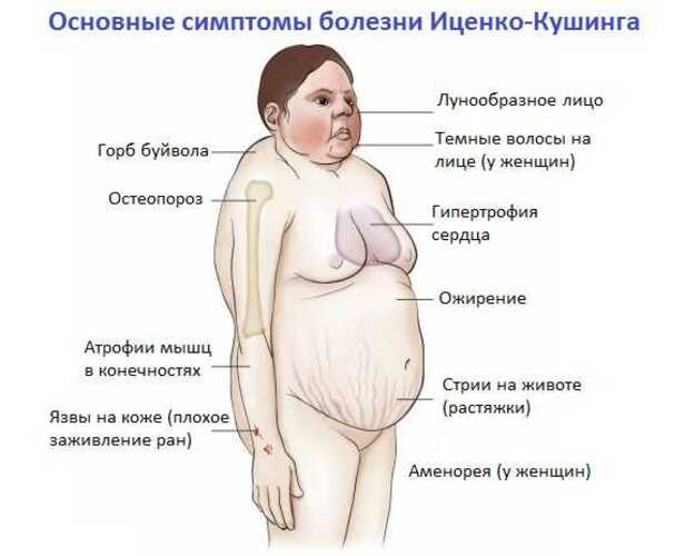 Хвороба Кушинга. Симптоми у жінок, фото, лікування. Дієта, народні рецепти