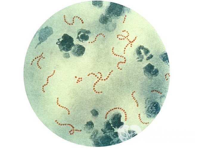 Найчастіше причиною бактеріальної ангіни є β-гемолітичний стрептокок групи А