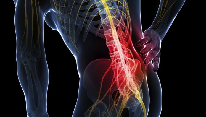 Що таке невралгія? Причини, симптоми І спосіб лікування