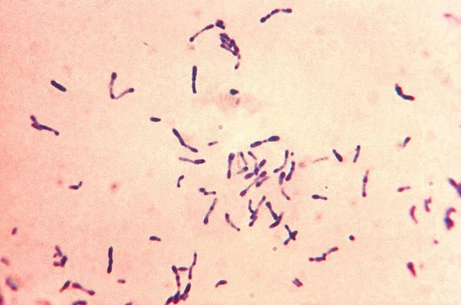 Дифтерійні палички (Corynebacterium diphtheriae) - грампозитивні паличкоподібні бактерії