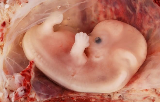 Ембріон людини