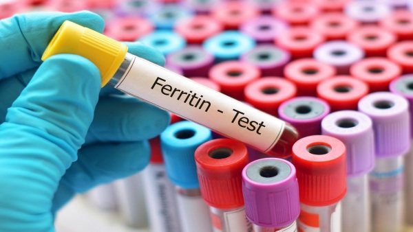 Ферритин в аналізі крови.  Що означає зниженя, підвіщеній у жінок, норма, причини и лікування
