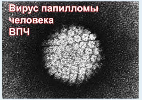 фото ВПЛ-вірусу під Електрон мікроскопом