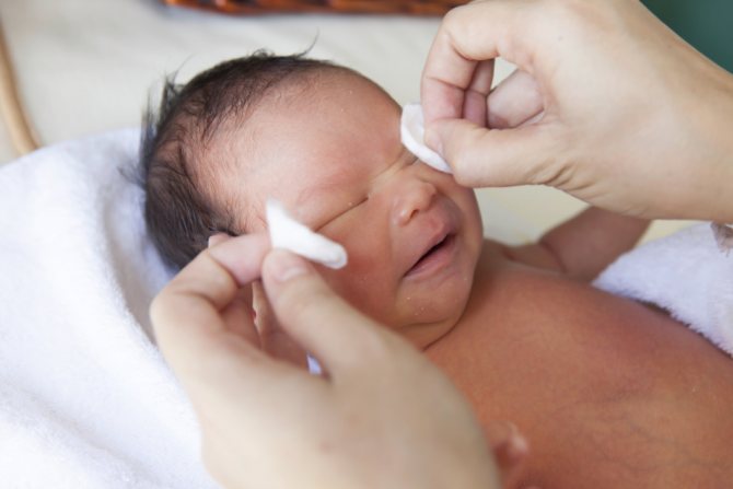 Гігієнічні процедури и закопування сульфацила натрію - обов'язкова профілактика гонобленнореи новонароджених