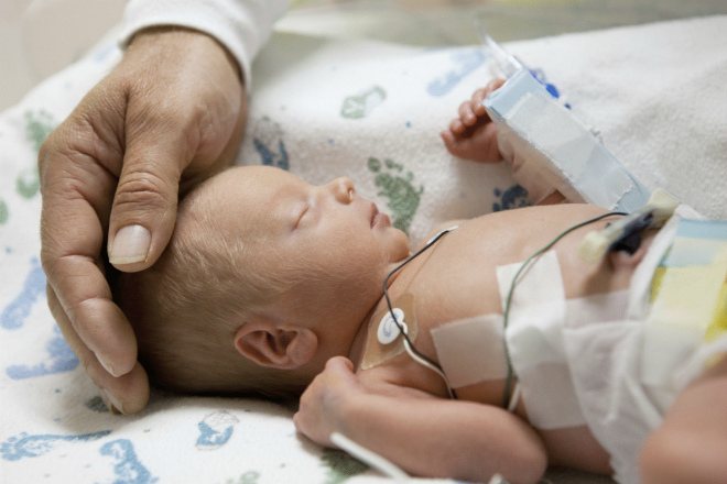 Гіпоксія легких у новонароджених. Що потрібно знати про гіпоксії новонароджених