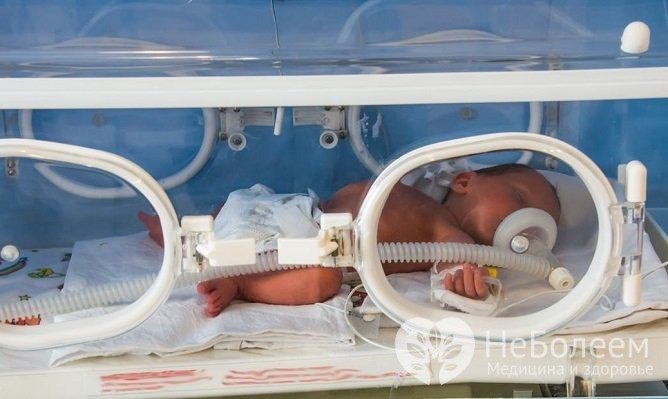 Гіпоксія у новонароджених: симптоми і лікування