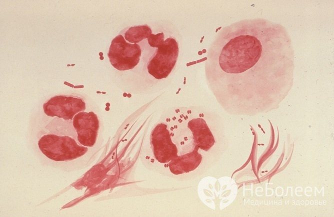 Гонокок Neisseria gonorrhoeae - Збудник гонореї