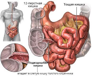 Ілюстрація анатомії худої и клубової кишки