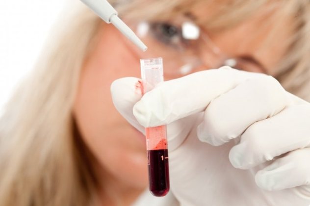 якісний и кількісній аналіз крови на ХГЛ
