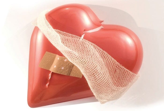 як лікувати аритмію серця