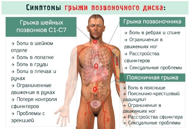 Мануальний терапевт. Що лікує у дорослих, дітей, що робить