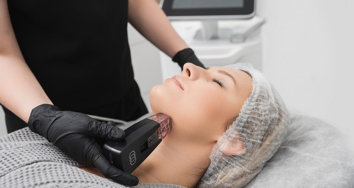 Мікроголки активують регенерацію