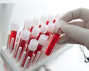 Загальний і біохімічний аналіз крові