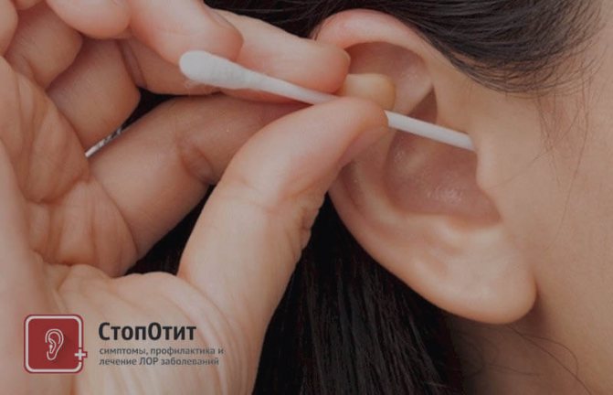 Очищення вух від сірки ватною паличкою