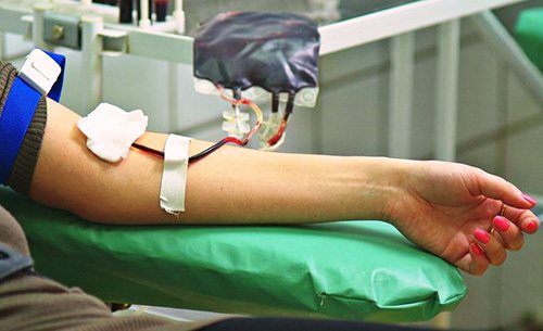 Переливання крові - це головний спосіб лікування артеріальної кровотечі, застосовуваний після його зупинки