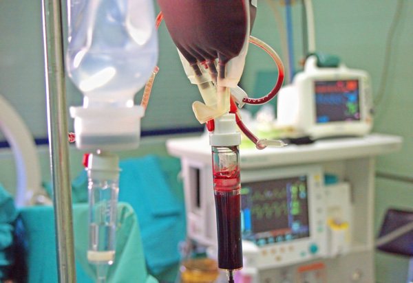 Переливання крові во время операции при розріві кісті з крововілівом