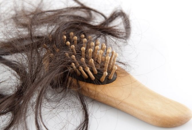 Чому віпадає волосся на Голові у жінок - причини, що робити, як лікуваті.  Народні рецепти від віпадіння волосся, маски