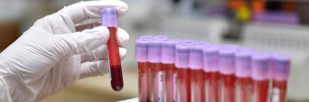 Показники аналізу крові для діагностики захворювань нирок