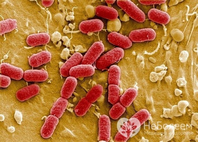 Причиною кишкових інфекцій в більшості випадків служать бактерії і віруси
