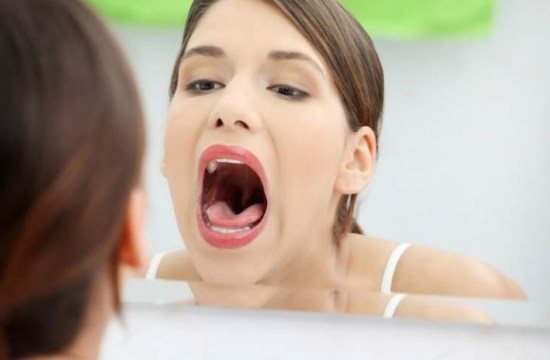 Причини біло-жовтого нальоту на язиці. Як усувати відкладення на мові