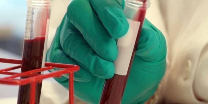 Пробірка з аналізом крові в руці у лаборанта
