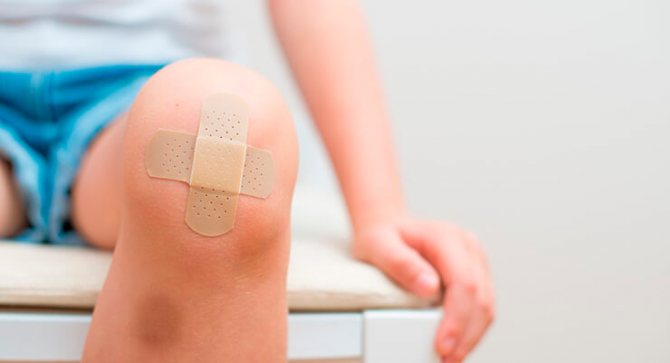 Сильний удар колінної чашечки при падінні лікування в домашніх умовах