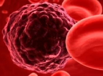 Так виглядає ракова клітина крові під електронним мікроскопом