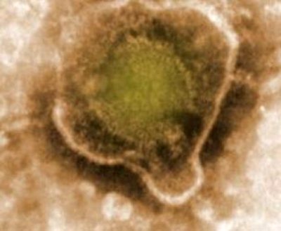 вірус під мікроскопом ЕБВІ