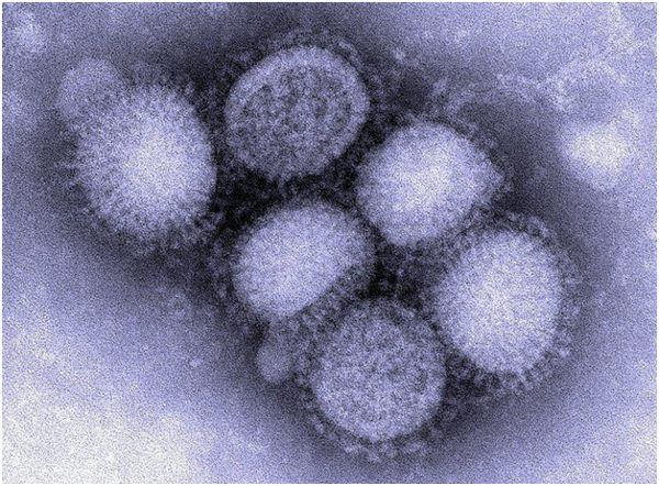 вірус свинячого грипу