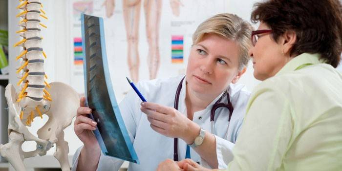 Лікар з пацієнткою розглядають рентгенівський знімок