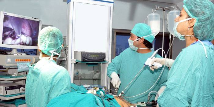 Лікарі проводять лапароскопічну операцію