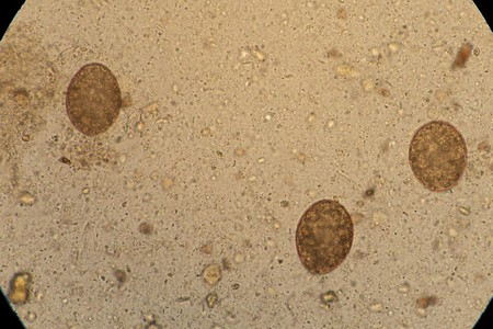 Яйця широкого лентеца під мікроскопом